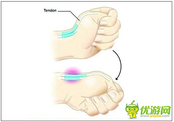 玩手機(jī)易患十大“智能手機(jī)病” 這些癥狀你都有嗎？
